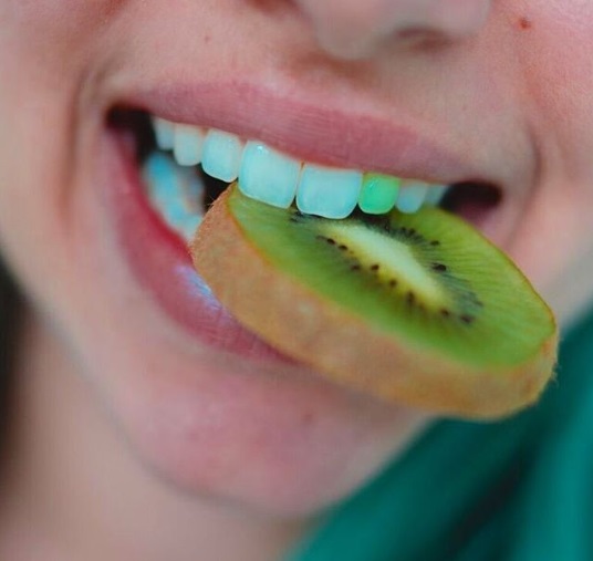 طلاء للأسنان بألوان يستخدم لاخفاء العيوب